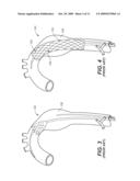 Endovascular Prosthesis for Ascending Aorta diagram and image