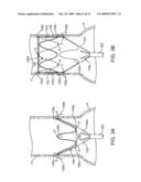 Prosthesis Fixation Apparatus and Methods diagram and image