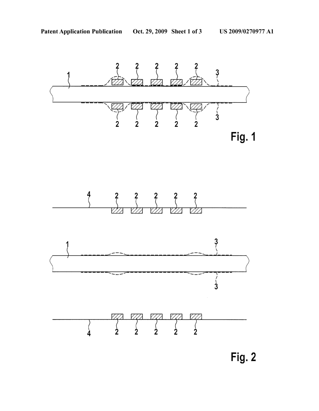 STENT FIXATION SYSTEM - diagram, schematic, and image 02