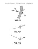 Methods and Devices for Improving Mitral Valve Function diagram and image