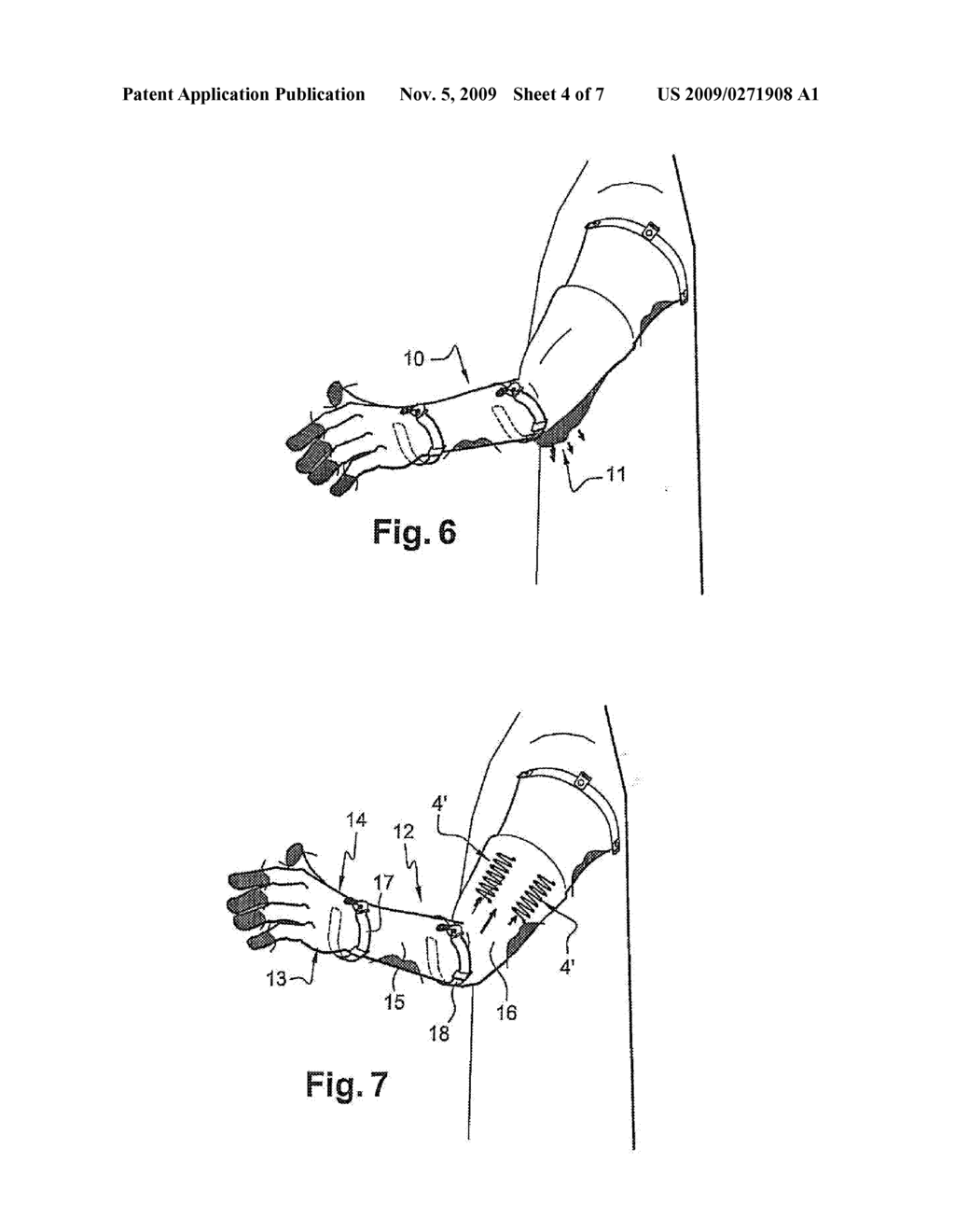 CHAIN MAIL ARTICLE PROVIDED WITH AN ELASTIC TIGHTENING OR TENSIONING BODY - diagram, schematic, and image 05