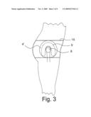 Garment, protection device and method for reducing the risk of bone fracture diagram and image