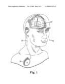 CAPACITY FADE ADJUSTED CHARGE LEVEL OR RECHARGE INTERVAL OF A RECHARGEABLE POWER SOURCE OF AN IMPLANTABLE MEDICAL DEVICE, SYSTEM AND METHOD diagram and image