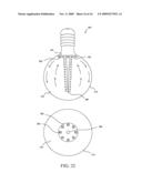 High power LED lamp with heat dissipation enhancement diagram and image