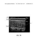 SYSTEMS, METHODS AND DEVICES FOR USE IN FILTER-BASED ASSESSMENT OF CARCASS GRADING diagram and image