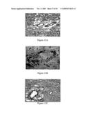 TUMOR VASCULATURE MARKERS AND METHODS OF USE THEROF diagram and image