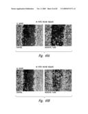 COMPOSITIONS AND METHODS FOR TREATING ASTHMA AND OTHER LUNG DISORDERS diagram and image