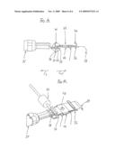 SLIDE CLIP diagram and image