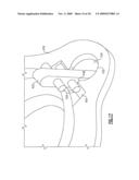 ARTICULATION MECHANISM FOR A VAGINAL SPECULUM diagram and image