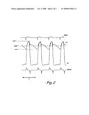 SYSTEM AND METHOD OF DETERMINING ARTERIAL BLOOD PRESSURE AND VENTRICULAR FILL PARAMETERS FROM VENTRICULAR BLOOD PRESSURE WAVEFORM DATA diagram and image