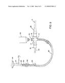 METHOD AND SYSTEM OF MEASURING IAP USING A NASO-ENTERIC TUBE diagram and image