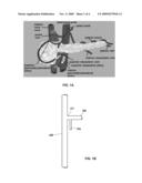 PANCREATIC DELIVERY CATHETER diagram and image