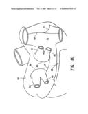 Ablation probe with stabilizing member diagram and image