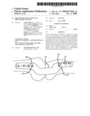 SHEATHS FOR EXTRA-ARTICULAR IMPLANTABLE SYSTEMS diagram and image