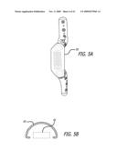 SHEATHS FOR EXTRA-ARTICULAR IMPLANTABLE SYSTEMS diagram and image