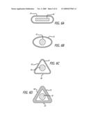 SHEATHS FOR EXTRA-ARTICULAR IMPLANTABLE SYSTEMS diagram and image