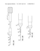 SHEATHS FOR EXTRA-ARTICULAR IMPLANTABLE SYSTEMS diagram and image