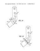 SHEATHS FOR EXTRA-ARTICULAR IMPLANTABLE SYSTEMS diagram and image