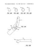 SHEATHS FOR EXTRA-ARTICULAR IMPLANTABLE SYSTEMS diagram and image