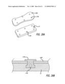 SHEATHS FOR EXTRA-ARTICULAR IMPLANTABLE SYSTEMS diagram and image