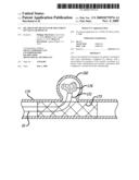 FILAMENTARY DEVICES FOR TREATMENT OF VASCULAR DEFECTS diagram and image