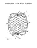 FILAMENTARY DEVICES FOR TREATMENT OF VASCULAR DEFECTS diagram and image