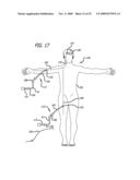 FILAMENTARY DEVICES FOR TREATMENT OF VASCULAR DEFECTS diagram and image