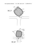 FILAMENTARY DEVICES FOR TREATMENT OF VASCULAR DEFECTS diagram and image