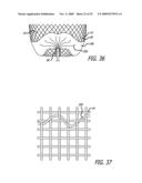 FILAMENTARY DEVICES FOR TREATMENT OF VASCULAR DEFECTS diagram and image