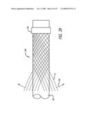 FILAMENTARY DEVICES FOR TREATMENT OF VASCULAR DEFECTS diagram and image