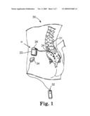 PRE-CONFIGURATION OF ELECTRODE MEASUREMENT OF AN IMPLANTABLE MEDICAL DEVICE, SYSTEM AND METHOD THEREFORE diagram and image