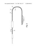 PRE-CONFIGURATION OF ELECTRODE MEASUREMENT OF AN IMPLANTABLE MEDICAL DEVICE, SYSTEM AND METHOD THEREFORE diagram and image