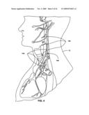 TECHNIQUES FOR PLACING MEDICAL LEADS FOR ELECTRICAL STIMULATION OF NERVE TISSUE diagram and image