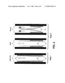 Implantable Prosthetic Valve diagram and image