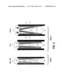 Implantable Prosthetic Valve diagram and image