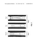 Implantable Prosthetic Valve diagram and image