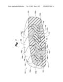 RAIL-BASED MODULAR DISC PROSTHESIS diagram and image