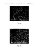 METHODS AND SYSTEMS TO PREDICT FATIGUE LIFE IN ALUMINUM CASTINGS diagram and image