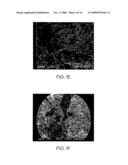 METHODS AND SYSTEMS TO PREDICT FATIGUE LIFE IN ALUMINUM CASTINGS diagram and image