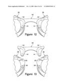 Aquatic Goggles diagram and image