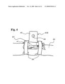 Bracket for use in curtain airbag and curtain airbag apparatus diagram and image