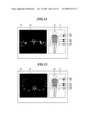 MEDICAL IMAGE DISPLAY PROCESSING APPARATUS AND MEDICAL IMAGE DISPLAY PROCESSING PROGRAM diagram and image