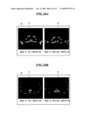 MEDICAL IMAGE DISPLAY PROCESSING APPARATUS AND MEDICAL IMAGE DISPLAY PROCESSING PROGRAM diagram and image