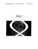 IMAGE RECONSTRUCTION DEVICE, IMAGE RECONSTRUCTION METHOD, IMAGE RECONSTRUCTION PROGRAM, AND CT APPARATUS diagram and image