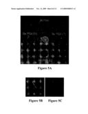 COMPOSITIONS AND METHODS FOR DETECTION, PREVENTION, AND TREATMENT OF ANTHRAX AND OTHER INFECTIOUS DISEASES diagram and image