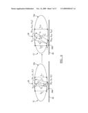 Method and apparatus for tracking a patient diagram and image