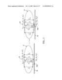 Method and apparatus for tracking a patient diagram and image