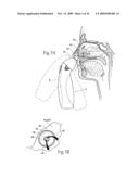 Irrigation and aspiration devices and methods diagram and image