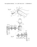 Irrigation and aspiration devices and methods diagram and image