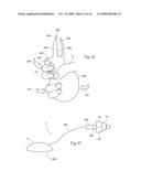 Irrigation and aspiration devices and methods diagram and image